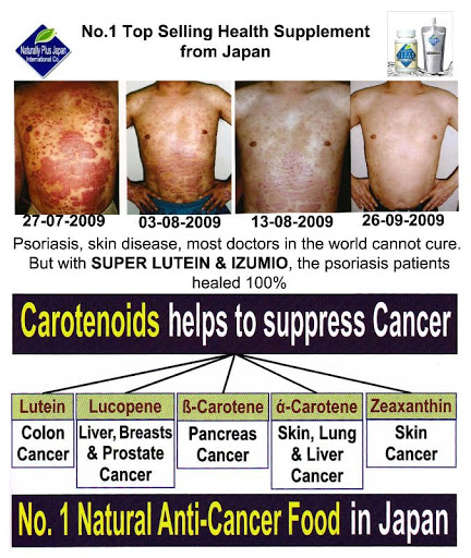 limfoma maligna adalah