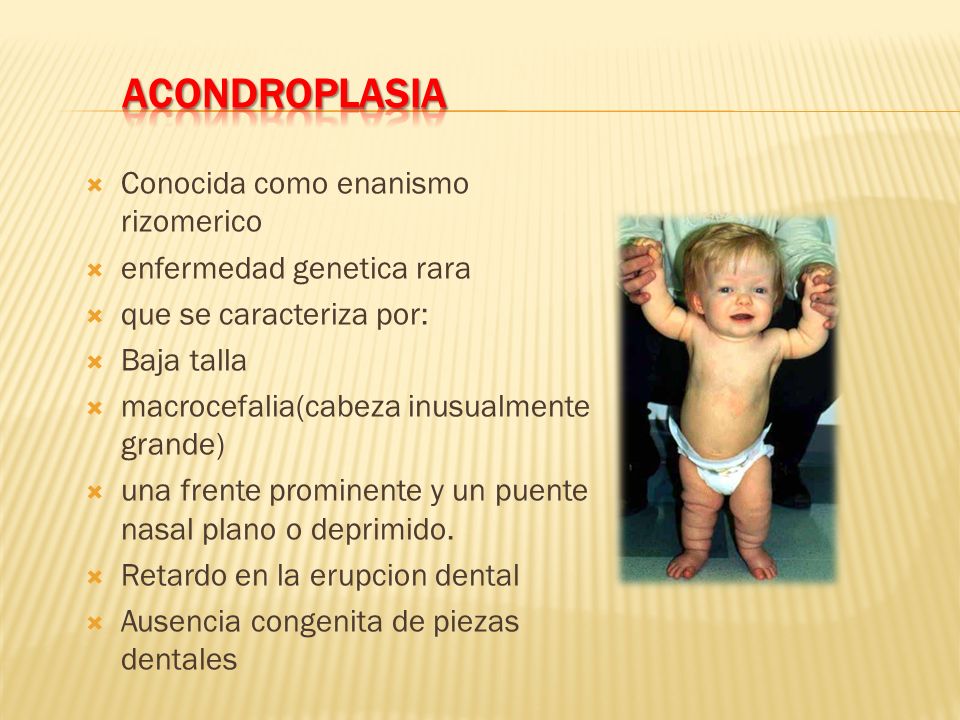 acondroplasia definicion