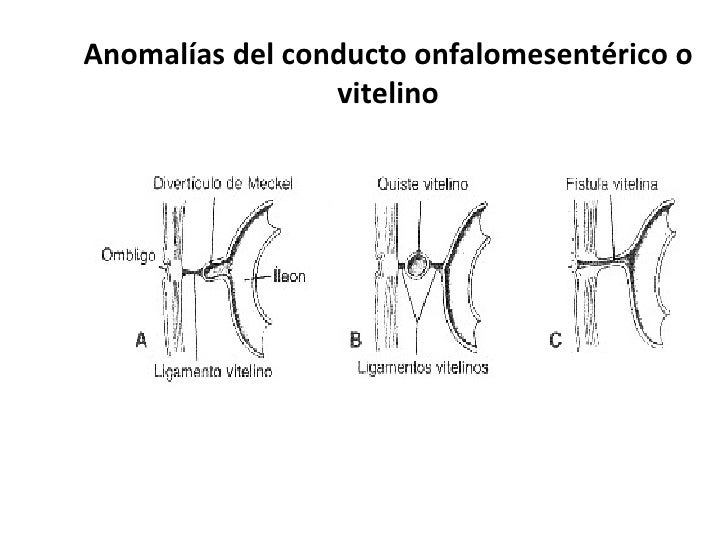 conducto onfalomesenterico