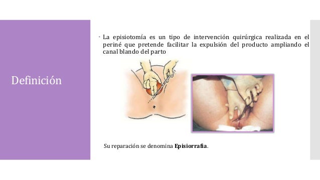 concepto de episiotomia y episiorrafia