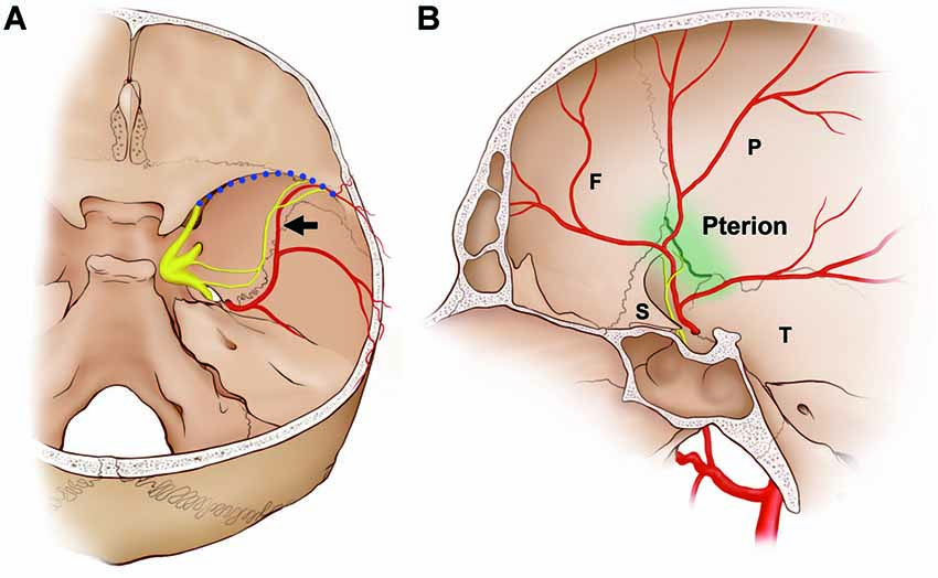dural headache and innervation of the dura mater
