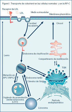 enfermedad de niemann pick tipo c