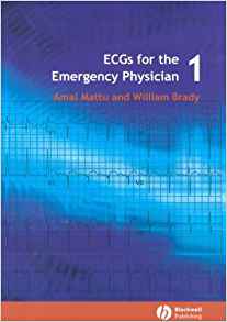 amal mattu ecg book