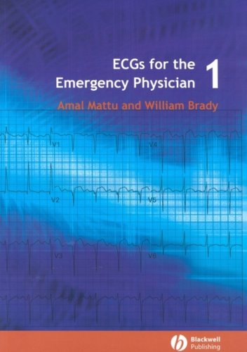 amal mattu ecg book