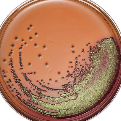 agar eosina y azul de metileno