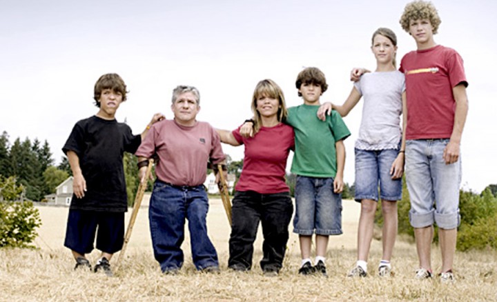 acondroplasia definicion