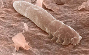 demodex folliculorum rosacea